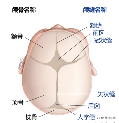 不一定是"睡偏了",警惕儿童颅缝早闭症!_颅骨_畸形_闭合
