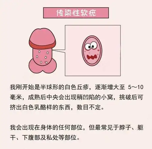 丁丁上长了小疙瘩!我是得性病了吗