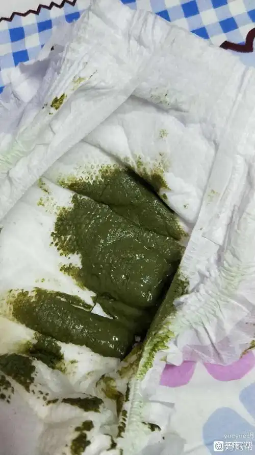 为什么孩子的大便总是绿色的? - 知乎