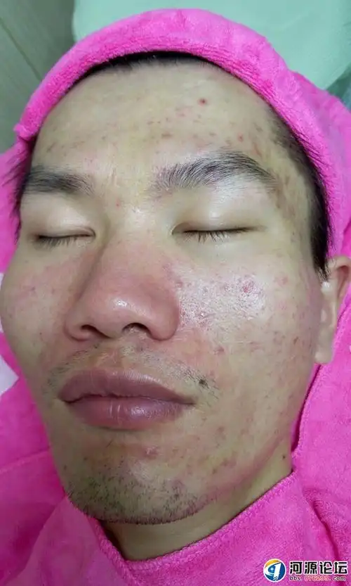 百年坤坊问题性皮肤修复中心!