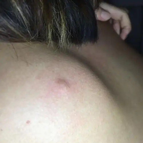 是什么东西,后背上的