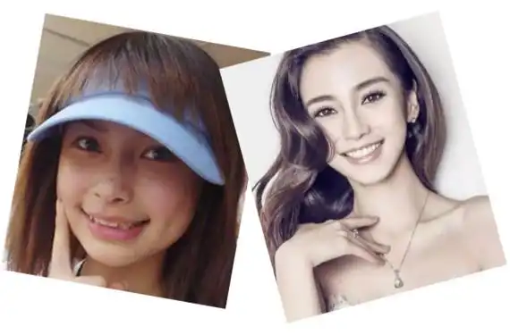 牙齿矫正对外貌改变有多大?