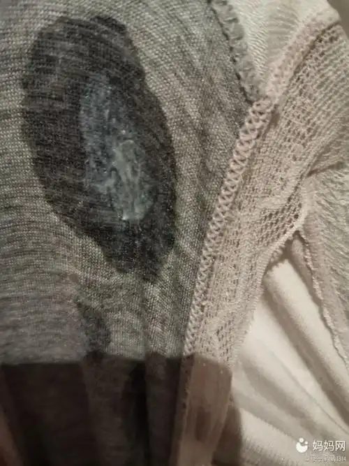 怀孕6周 6天白带是水样的,正常吗?有没有跟我一样的孕妈