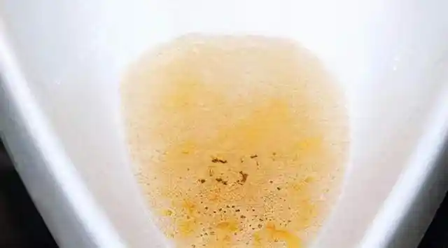 正常来说,尿液是呈淡黄色的,深黄色说明可能上火了,也有可能肝脏是