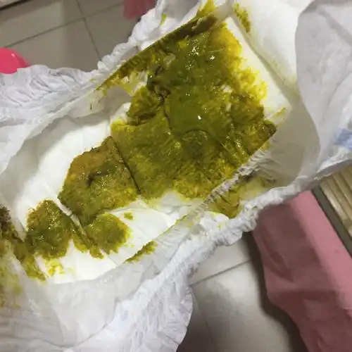 宝宝这两天拉屎有点块状,稠稠的.母乳.正常吗