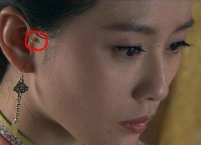 宝宝耳朵上有"拴马桩"代表有福气?