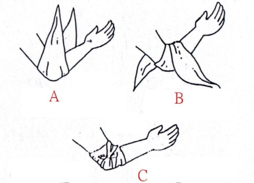 三角巾包扎之方法