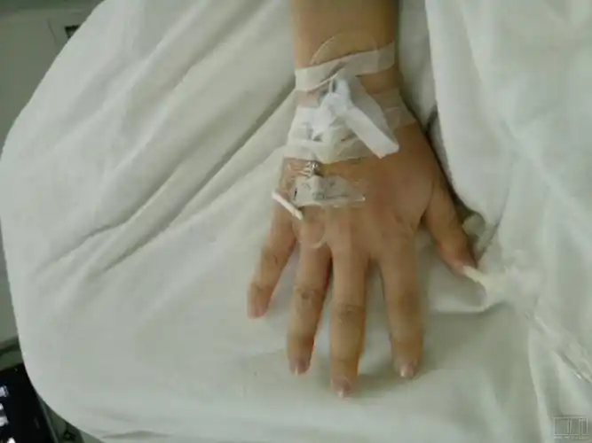 挂水螺丝针为什么老有血出来