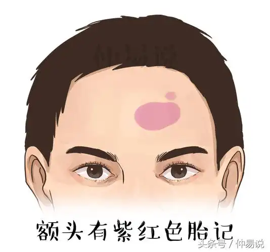 额头痣的寓意(额头有痣,斑,胎记寓意,看你一生的命运好不好)