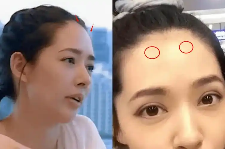 日月角高耸有起势,有贵格,面相学中称之"头角峥嵘,少年得志",有份好