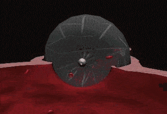 这时候我们就可以根据尺寸,通过这根空腔的导管再送进封堵器: 3  送