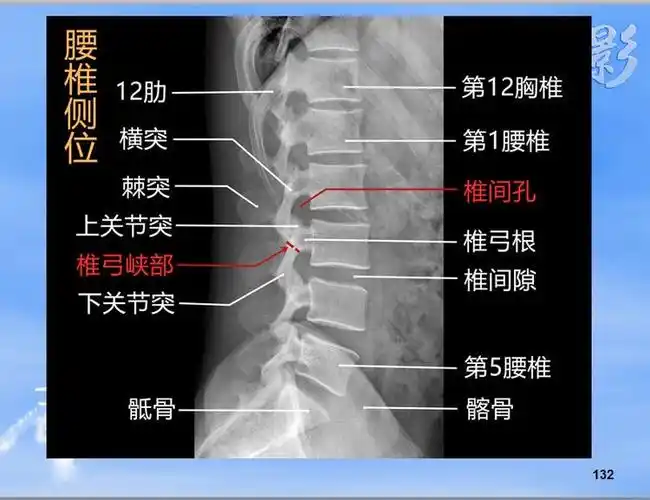 龙影 第四课 基础影像学之胸腰椎x线诊断