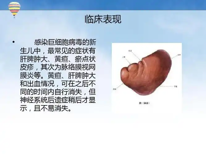 巨细胞病毒患儿的护理措施