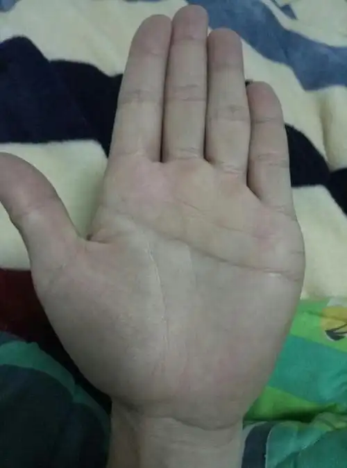 男,左手断掌,,有大师会看手相吗?麻烦帮忙看看,,,谢谢