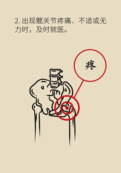 激素会带来股骨头坏死的后遗症吗?