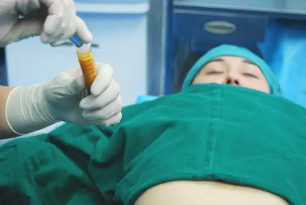 实拍女星丰胸抽脂手术全过程