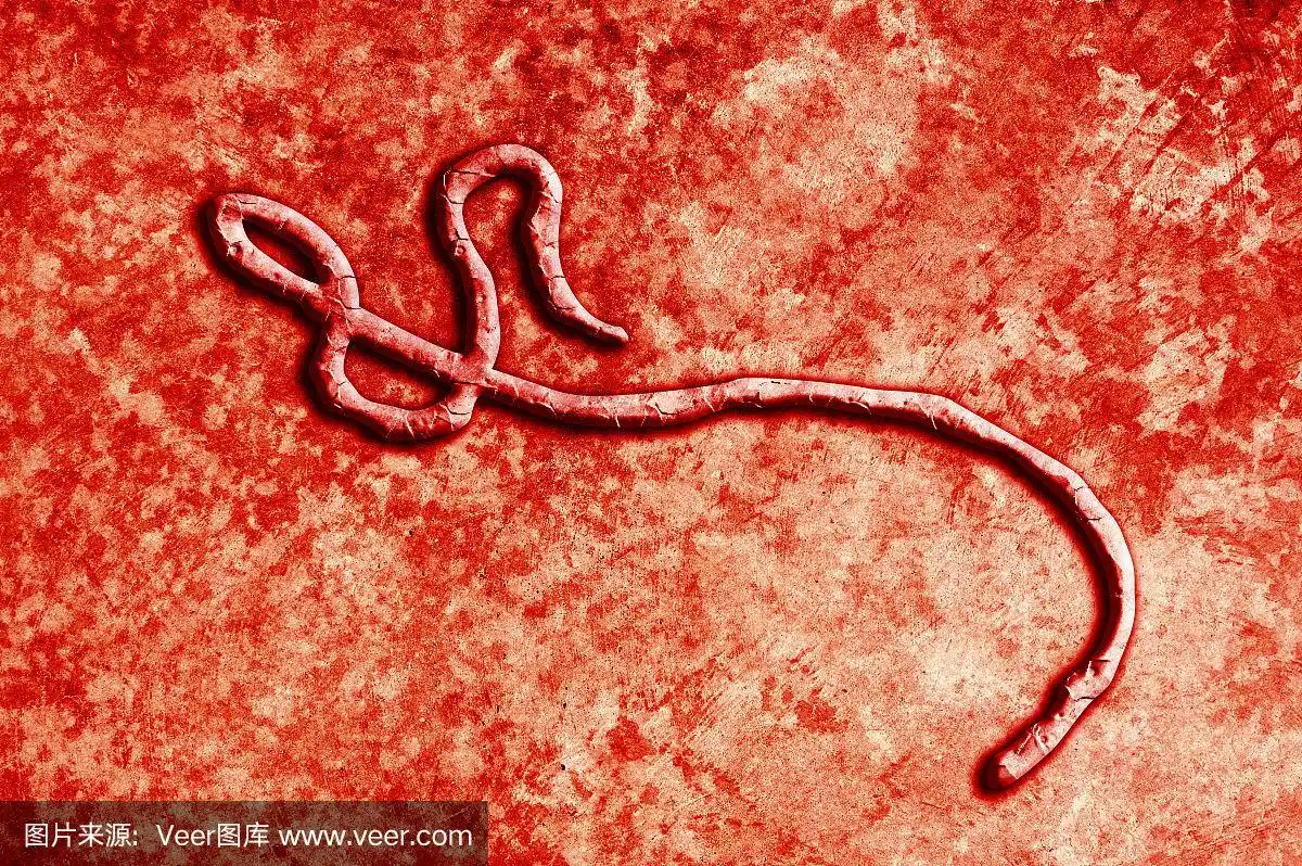 埃博拉病毒(点击查看更多)