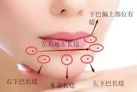 下巴长痣是吉还是凶奇准无比