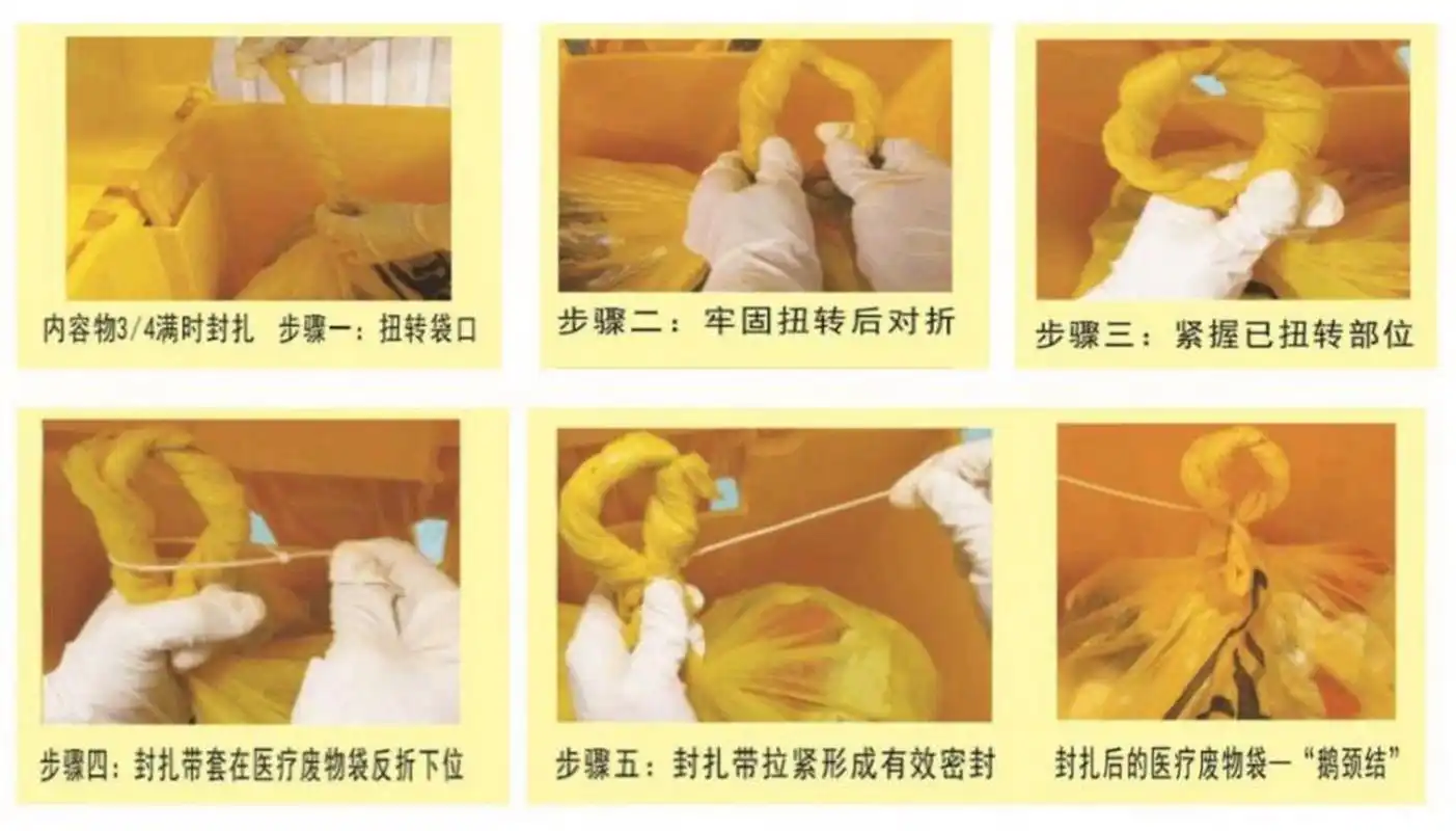 医疗垃圾鹅颈式结扎法 医疗垃圾规范化结扎,暂时储存,转运,无害化处理