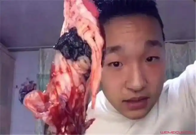 快手社会你胜哥现状 社会你胜哥为什么没手