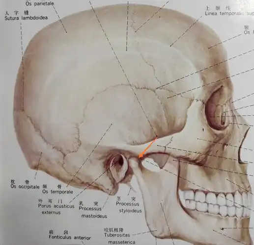 趣谈"脱下巴"_颞下颌关节脱位_介绍_治疗方式 - 好大夫在线