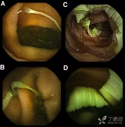 a 箭头所示为头节,图 b-d 显示由众多节片组成的横裂体