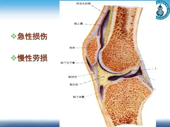 10李小群---中西医结合治疗髌下脂肪垫损伤