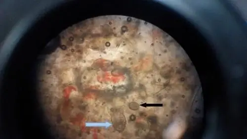 显微镜下,疥螨和卵.蓝色箭头为螨虫成虫,黑色箭头为螨虫卵.