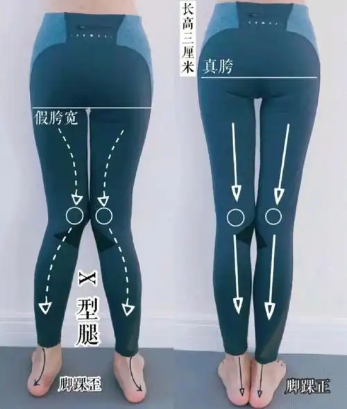 你有x型腿吗71腿型矫正的五步训练