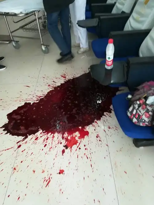 惊悚!余姚一男子输液时突然大量呕血,经抢救转危为安