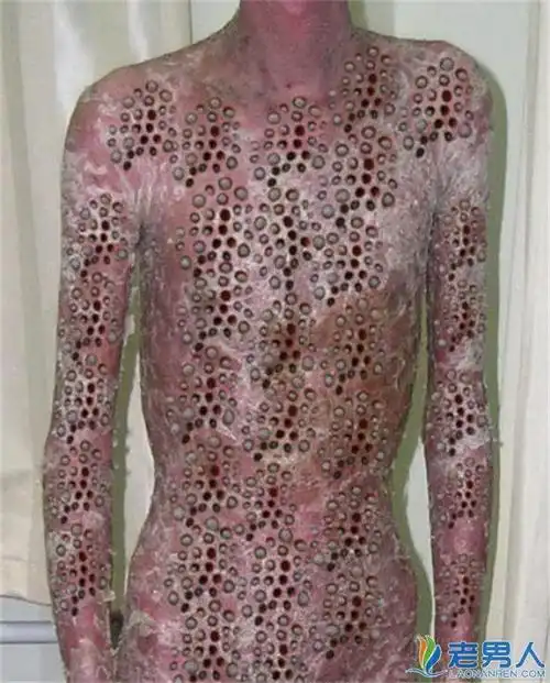 芝麻女孩恶心反人类 毛孔挑芝麻到底是真是假 / 比乐族