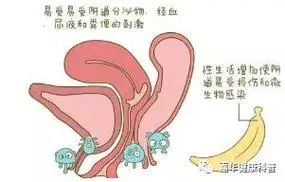 女性外阴长疙瘩是怎么回事