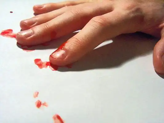 手指流血图片52