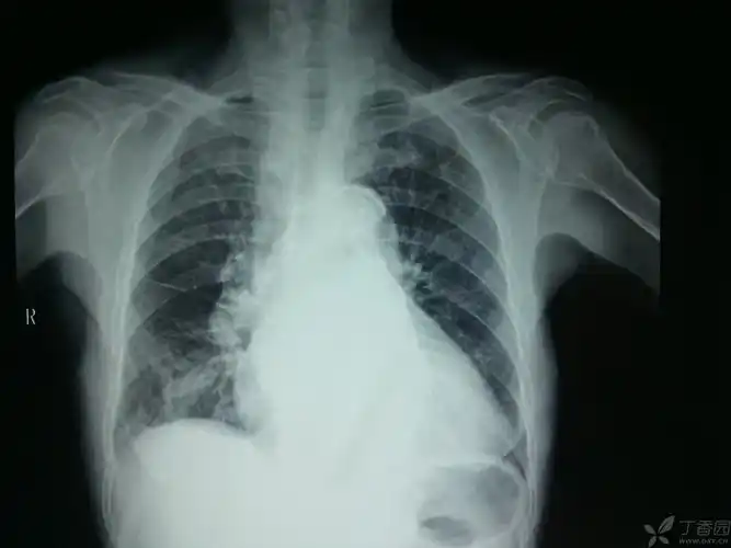 丁香园论坛 - 专业医生社区,医学,药学,生命科学,科研学术交流