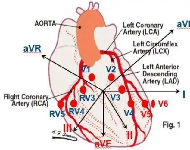 心电图个导联分布图
