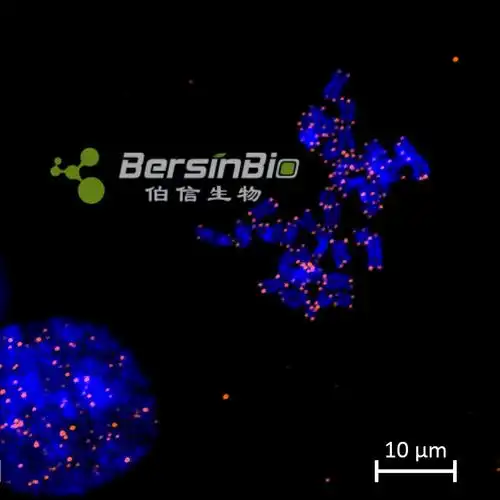 dna荧光原位杂交dnafish