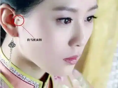 提到"仓眼",不少人就会联想到"拴马桩",也就是有些人耳朵旁边多长出