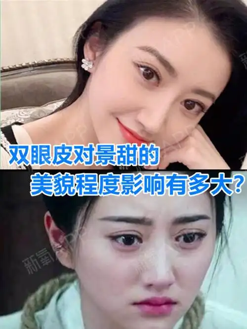 双眼皮对景甜的美貌程度影响有多大?