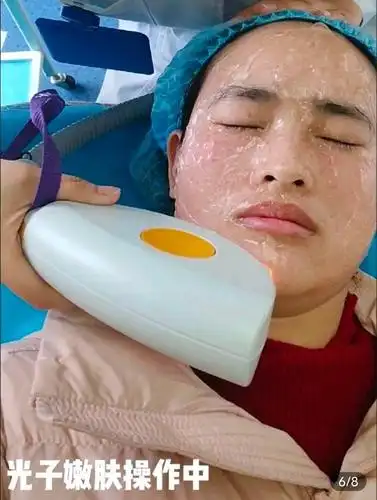 第二次光子嫩肤,原来单模式和全模式的区别在这里!