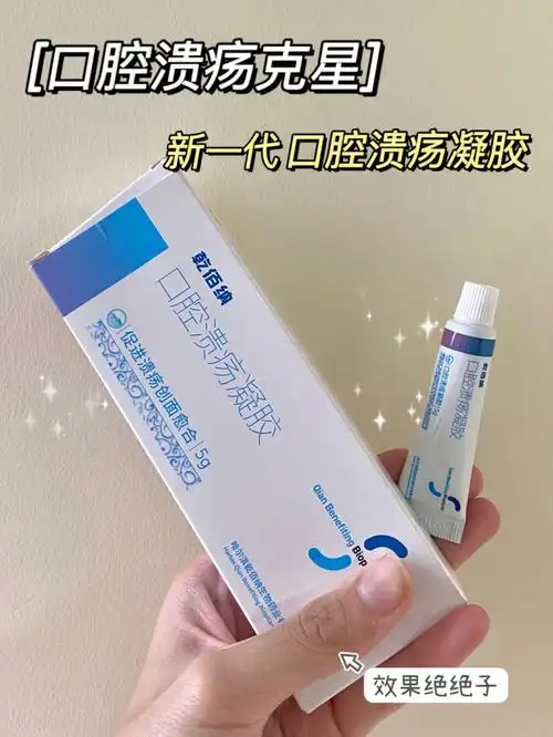 口腔溃疡克星口腔溃疡凝胶分享