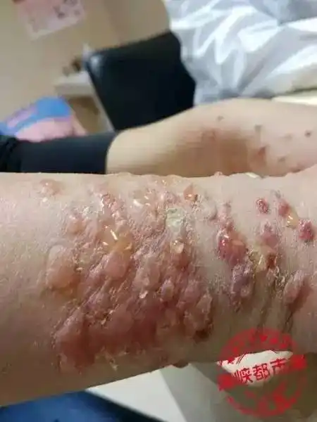 白蚁咬坏了南宁青竹立交呵呵