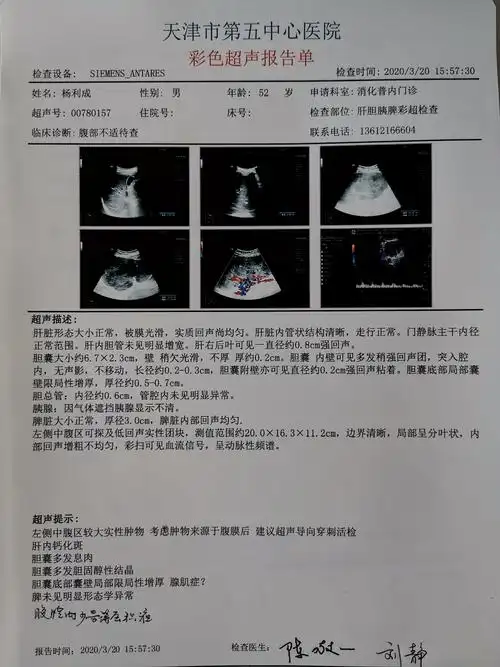 患者腹部彩超检查