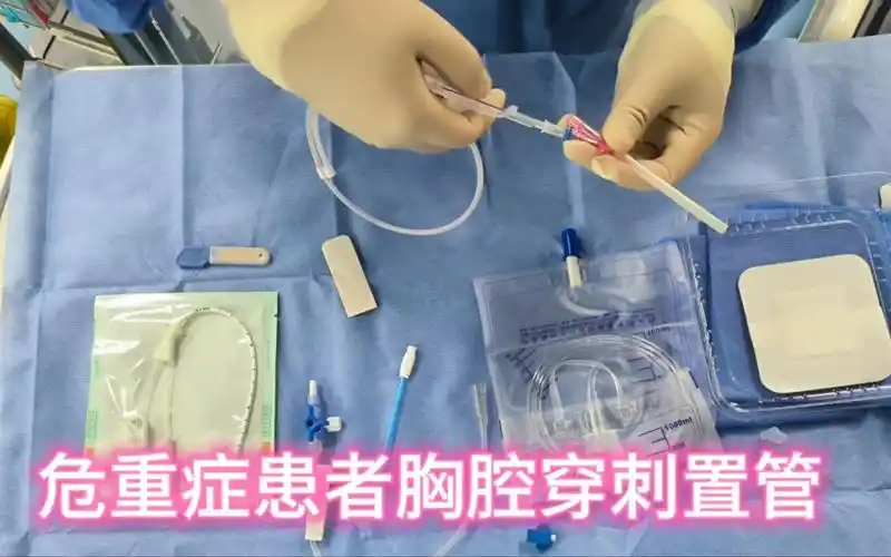 危重症卧位胸腔穿刺置管