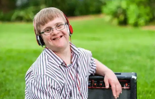 唐氏综合症的人长相一模一样我们如何来预防此种疾病