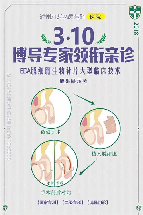 泸州九龙脱细胞生物补片技术 泸州将迎来降温降雨天气 气温将降至11