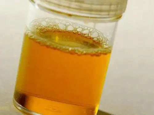 男性正常尿液泡沫图片 - 搜狗图片搜索