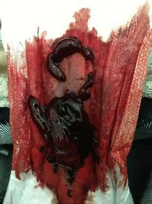 早孕药流排出的孕囊形状图片