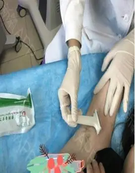 备皮的目的:不损伤皮肤完整性的前提下减少皮肤细菌数量,降低手术后