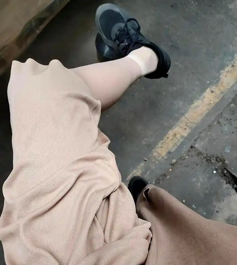 我这样的腿型是否正常?