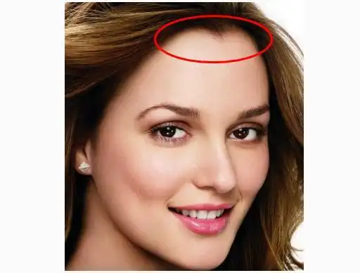 "美人尖"很美,但如果倒着长会怎样?